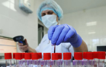 Azərbaycanda 25 mindən artıq insana koronavirus testi edilib