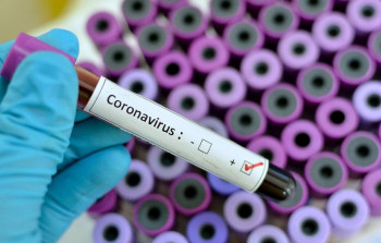 Azərbaycanda daha 41 nəfər koronavirusa yoluxdu